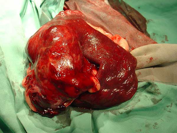 How Does Hemangiosarcoma In Dogs Affect Your Australian Shepherd - Photo: Hemangiosarcoma of the spleen in a dog. The tumor is on the left, and normal spleen is on the right.