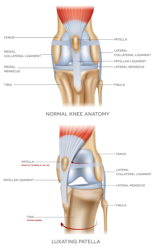 How Luxating Patella in Dogs Can Affect Your Aussie - Photo: Medical illustration of normal knee and luxating patella in dogs.