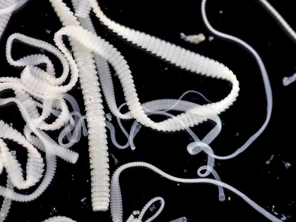 Does Your Australian Shepherd Have Tapeworms? - Photo: Image of several tapeworms (Dipylidium caninum).